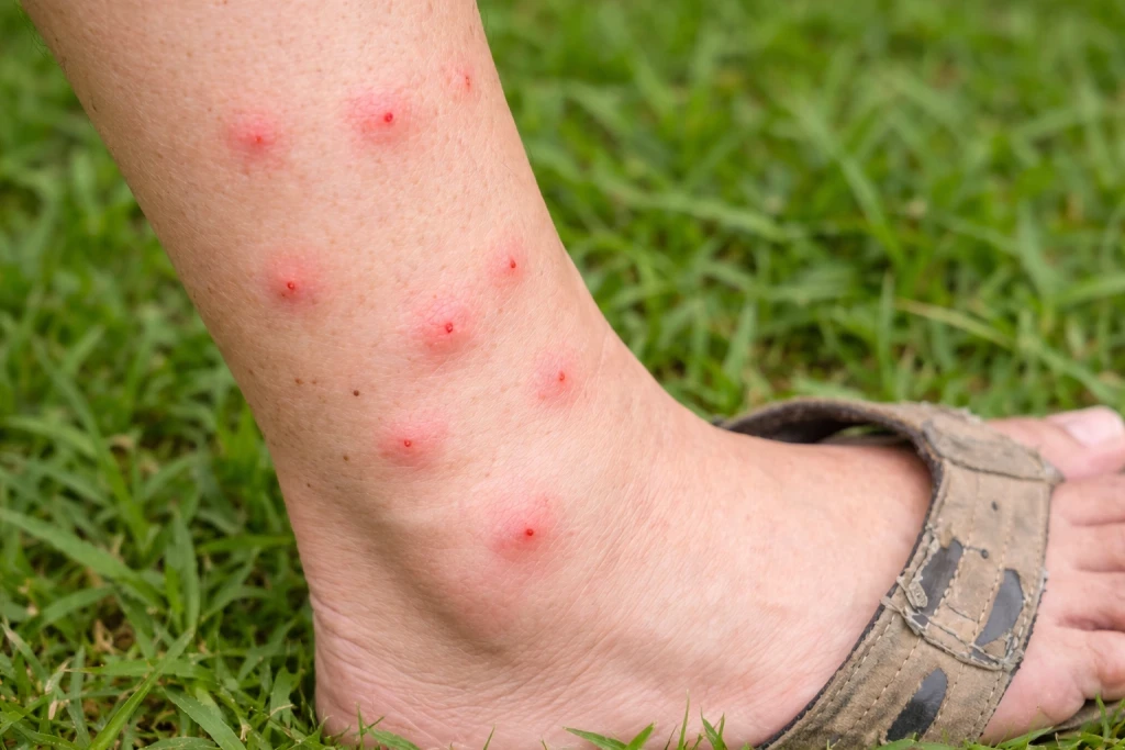 Mosquito control treatment in Cordova, TN